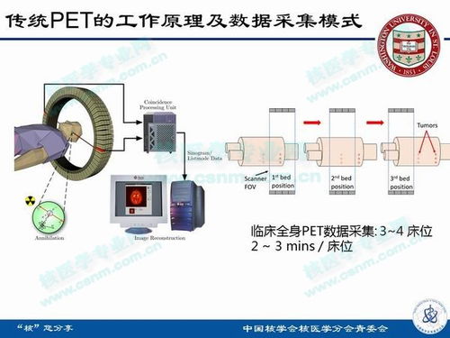 华盛顿大学医学院新型pet系统的研发